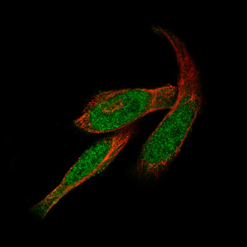 GLI-1 Antibody (CL12193) - Azide and BSA Free Immunocytochemistry/ Immunofluorescence: GLI-1 Antibody [NBP3-44013]