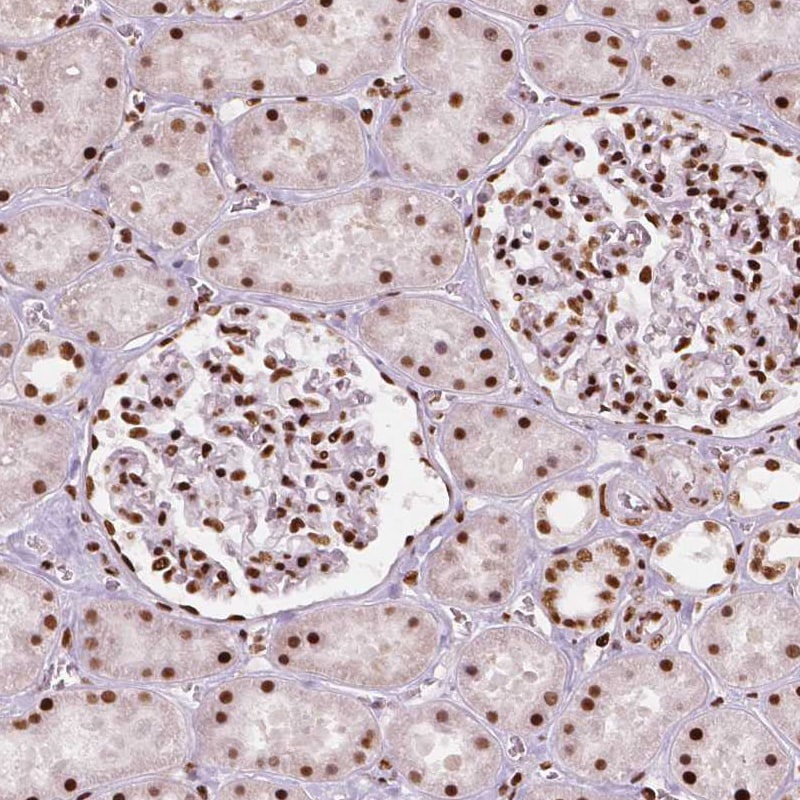 BRD4 Antibody (CL1118) - Azide and BSA Free Immunohistochemistry-Paraffin: BRD4 Antibody [NBP3-44014]