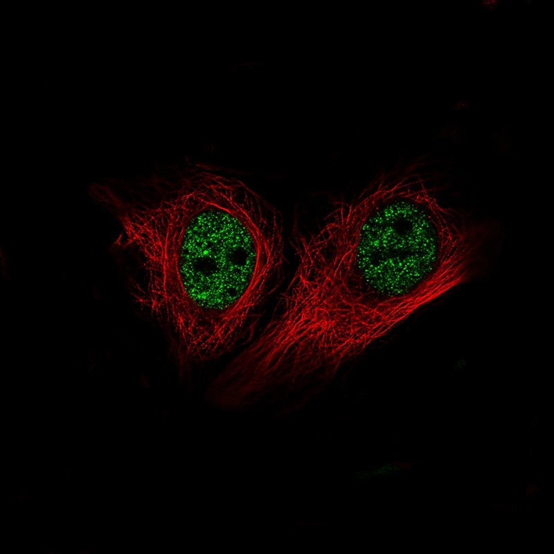 BRD4 Antibody (CL1118) - Azide and BSA Free Immunocytochemistry/ Immunofluorescence: BRD4 Antibody [NBP3-44014]