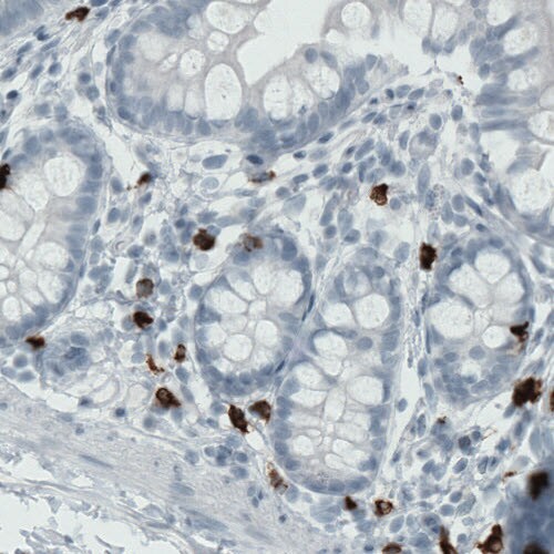 MMP-9 Antibody (CL0538) - Azide and BSA Free Immunohistochemistry-Paraffin: MMP-9 Antibody [NBP3-44015]