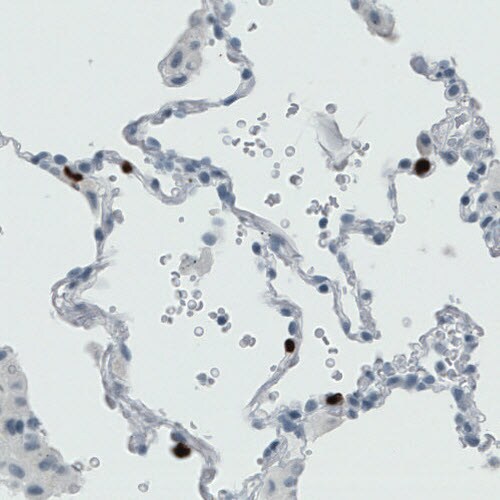 MMP-9 Antibody (CL0538) - Azide and BSA Free Immunohistochemistry-Paraffin: MMP-9 Antibody [NBP3-44015]