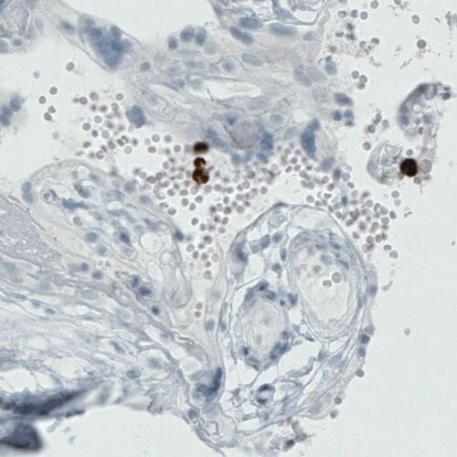 MMP-9 Antibody (CL0538) - Azide and BSA Free Immunohistochemistry-Paraffin: MMP-9 Antibody [NBP3-44015]