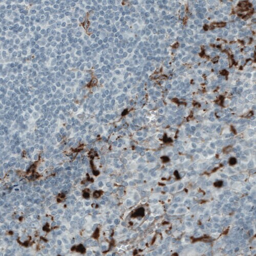 MMP-9 Antibody (CL0538) - Azide and BSA Free Immunohistochemistry-Paraffin: MMP-9 Antibody [NBP3-44015]