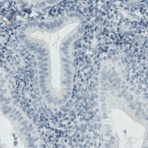 MMP-9 Antibody (CL0538) - Azide and BSA Free Immunohistochemistry-Paraffin: MMP-9 Antibody [NBP3-44015]