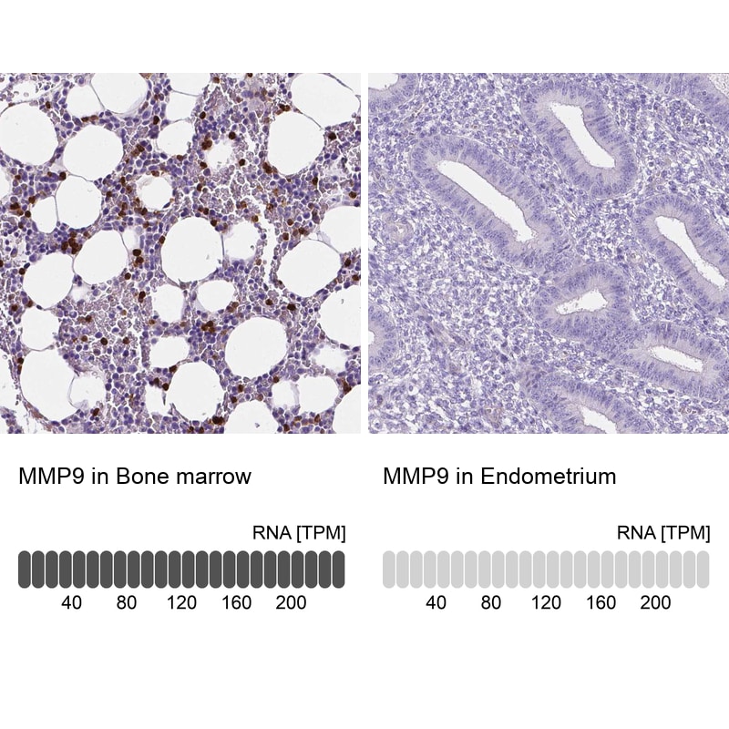 MMP-9 Antibody (CL0539) - Azide and BSA Free Immunohistochemistry-Paraffin: MMP-9 Antibody [NBP3-44016]