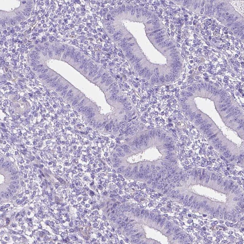 MMP-9 Antibody (CL0539) - Azide and BSA Free Immunohistochemistry-Paraffin: MMP-9 Antibody [NBP3-44016]