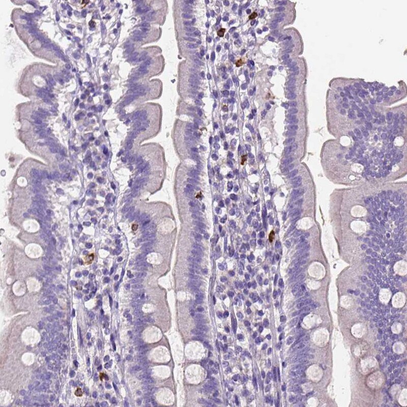 MMP-9 Antibody (CL0539) - Azide and BSA Free Immunohistochemistry-Paraffin: MMP-9 Antibody [NBP3-44016]