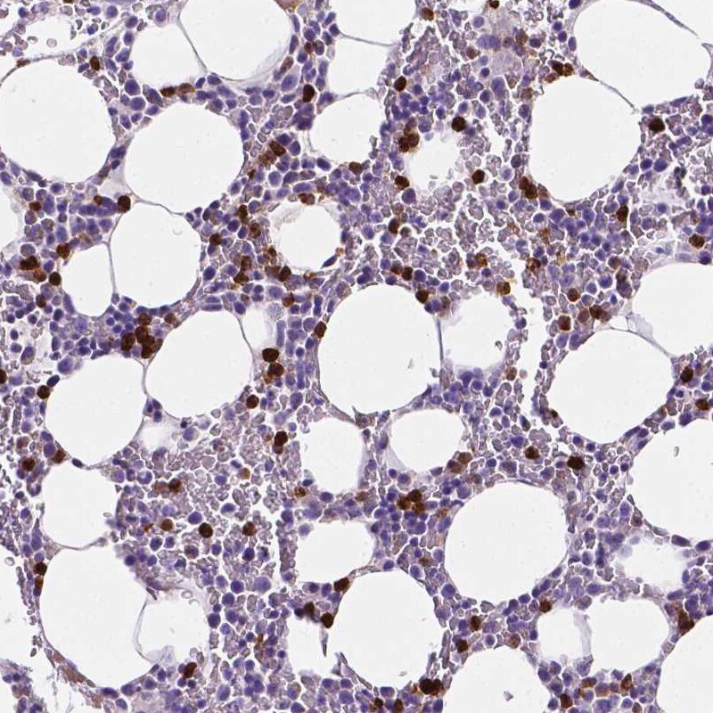 MMP-9 Antibody (CL0539) - Azide and BSA Free Immunohistochemistry-Paraffin: MMP-9 Antibody [NBP3-44016]