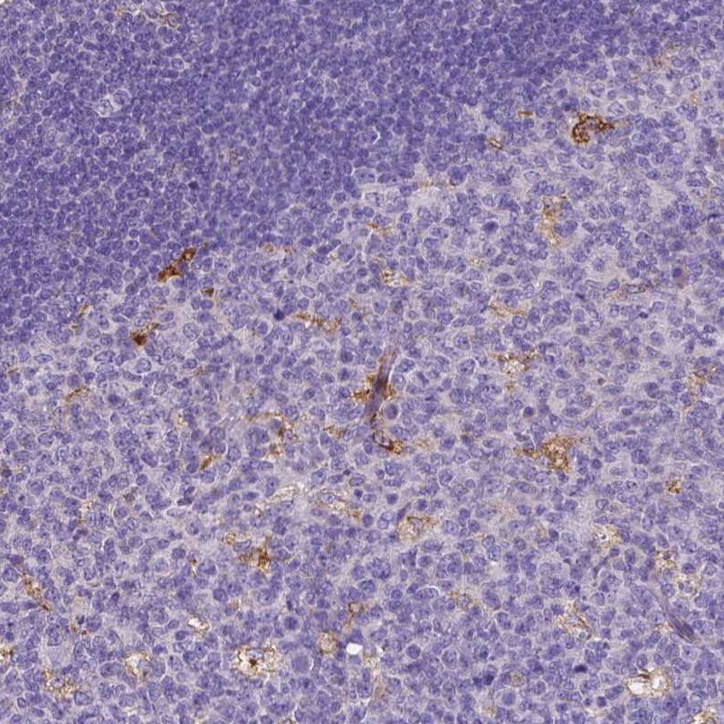 MMP-9 Antibody (CL0539) - Azide and BSA Free Immunohistochemistry-Paraffin: MMP-9 Antibody [NBP3-44016]