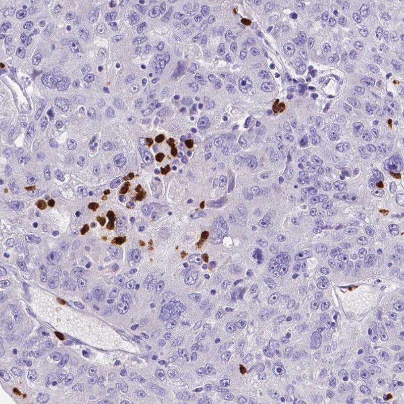 MMP-9 Antibody (CL0539) - Azide and BSA Free Immunohistochemistry-Paraffin: MMP-9 Antibody [NBP3-44016]