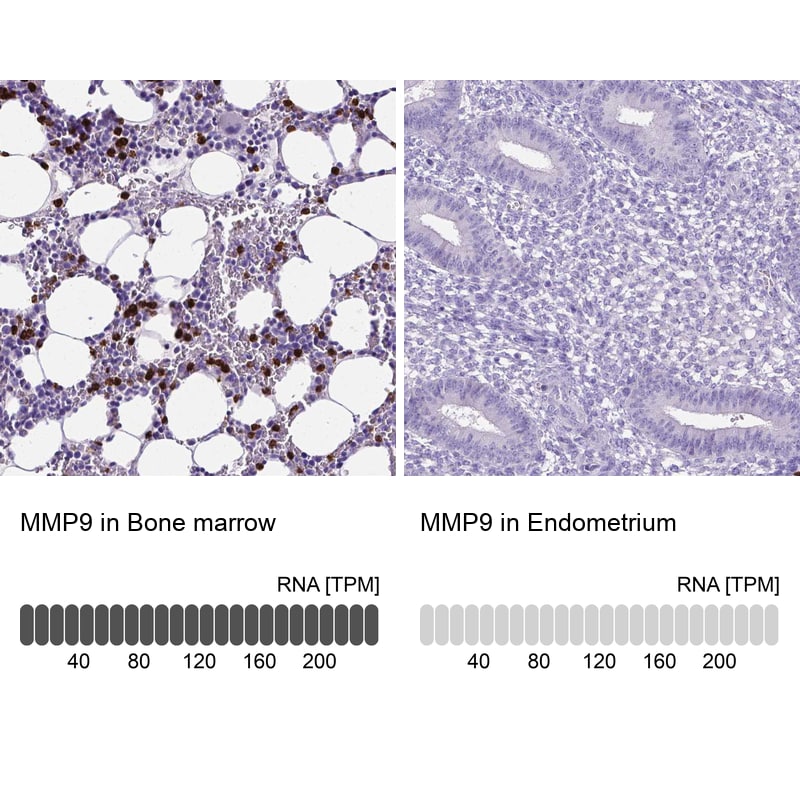 MMP-9 Antibody (CL0542) - Azide and BSA Free Immunohistochemistry-Paraffin: MMP-9 Antibody [NBP3-44017]