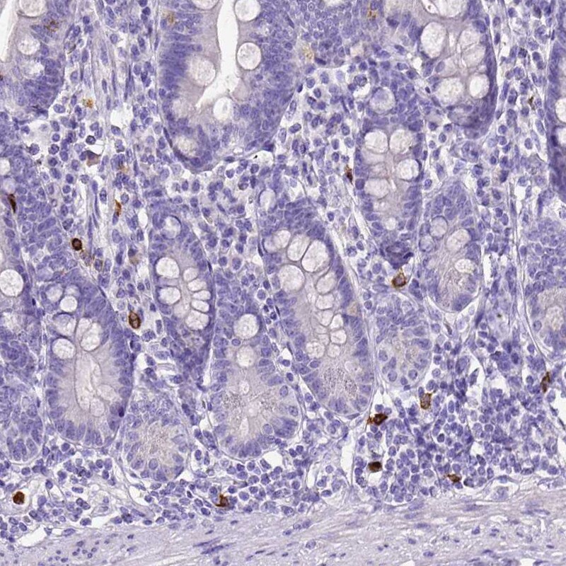 MMP-9 Antibody (CL0542) - Azide and BSA Free Immunohistochemistry-Paraffin: MMP-9 Antibody [NBP3-44017]