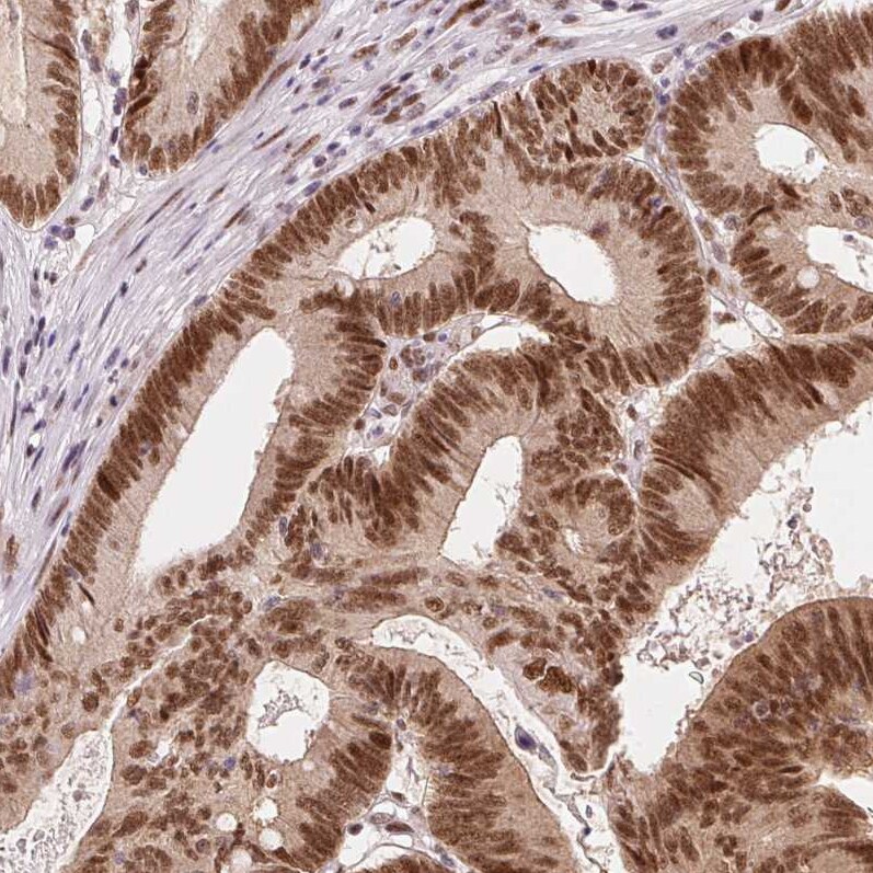 ZNF703 Antibody (CL0654) - Azide and BSA Free Immunohistochemistry-Paraffin: ZNF703 Antibody [NBP3-44019]