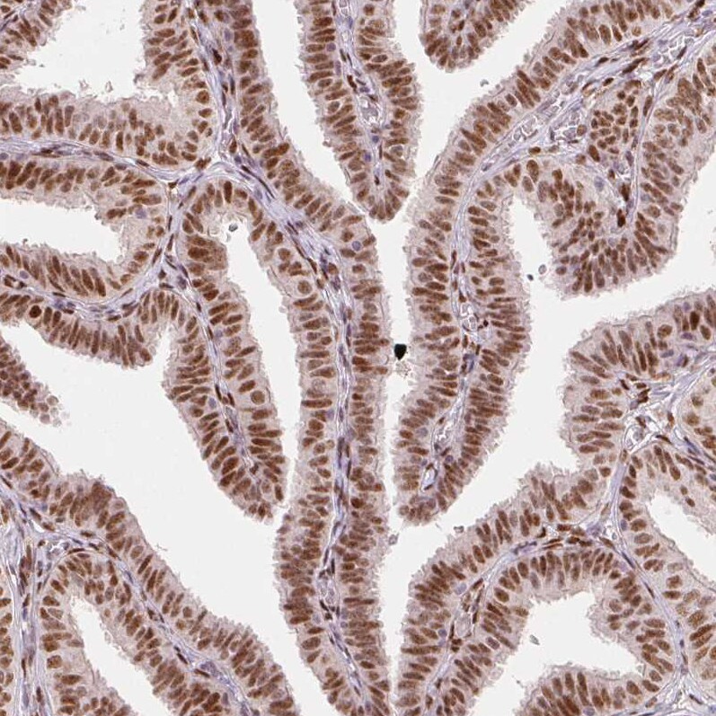 ZNF703 Antibody (CL0654) - Azide and BSA Free Immunohistochemistry-Paraffin: ZNF703 Antibody [NBP3-44019]