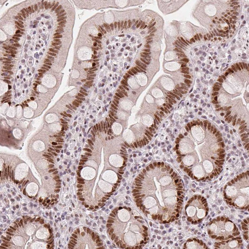 ZNF703 Antibody (CL0654) - Azide and BSA Free Immunohistochemistry-Paraffin: ZNF703 Antibody [NBP3-44019]