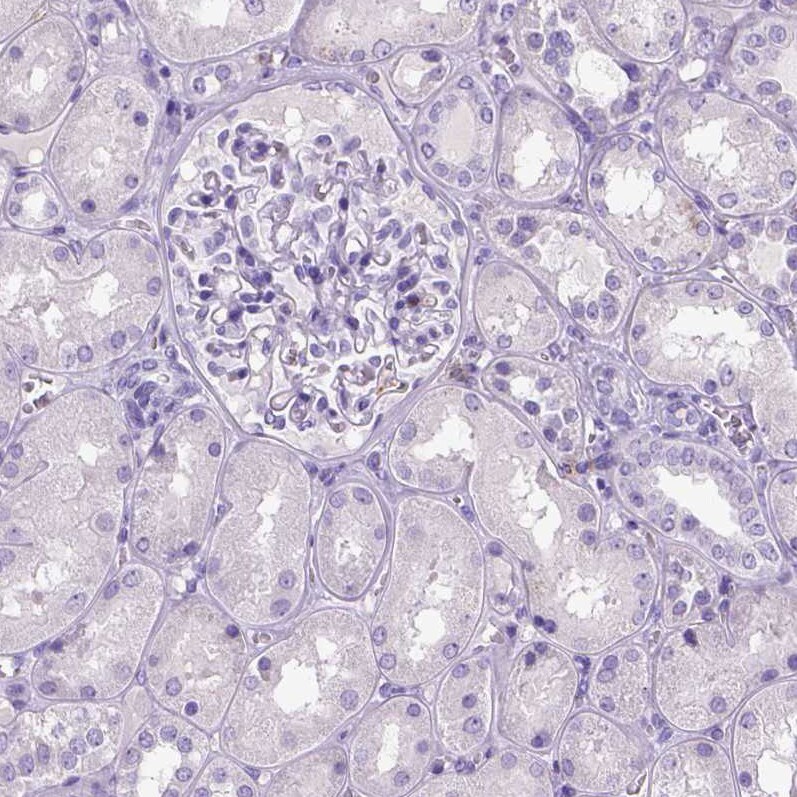 CD11c Antibody (CL1831) - Azide and BSA Free Immunohistochemistry-Paraffin: CD11c Antibody [NBP3-44020]