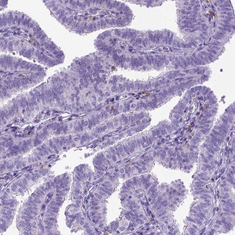 CD11c Antibody (CL1831) - Azide and BSA Free Immunohistochemistry-Paraffin: CD11c Antibody [NBP3-44020]