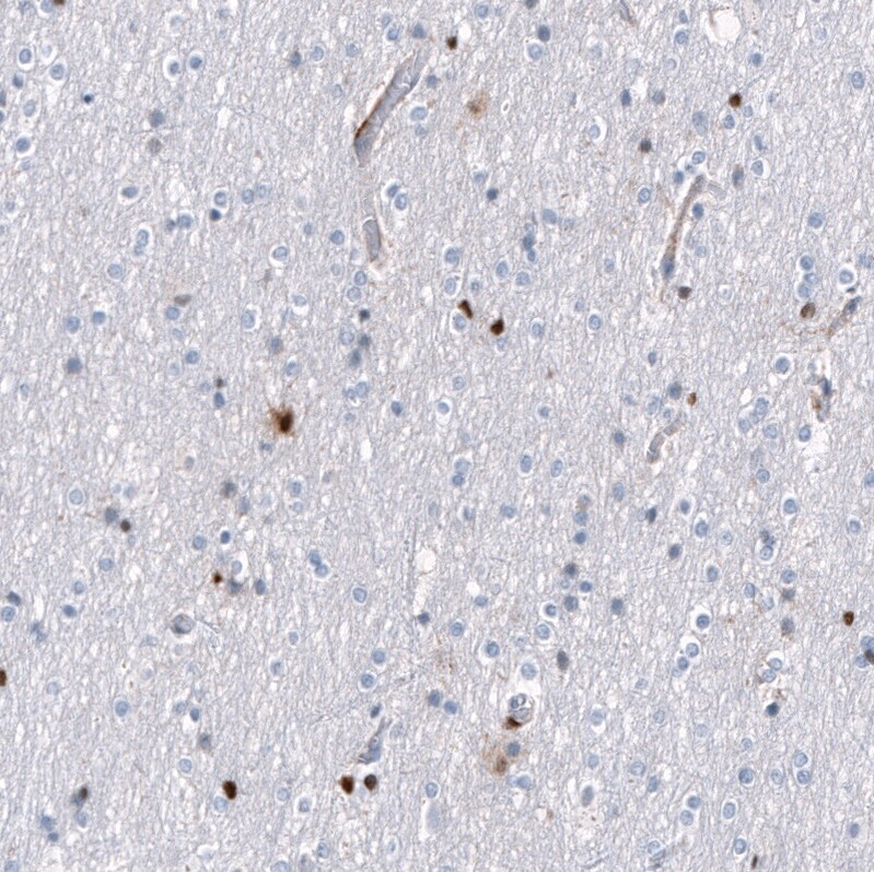 Serpin A3/alpha 1-Antichymotrypsin Antibody (CL10697) - Azide and BSA Free Immunohistochemistry-Paraffin: Serpin A3/alpha 1-Antichymotrypsin Antibody [NBP3-44021]