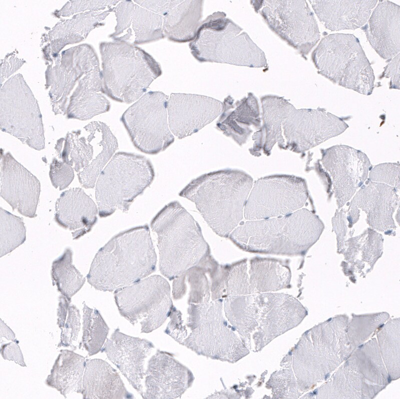 Serpin A3/alpha 1-Antichymotrypsin Antibody (CL10697) - Azide and BSA Free Immunohistochemistry-Paraffin: Serpin A3/alpha 1-Antichymotrypsin Antibody [NBP3-44021]