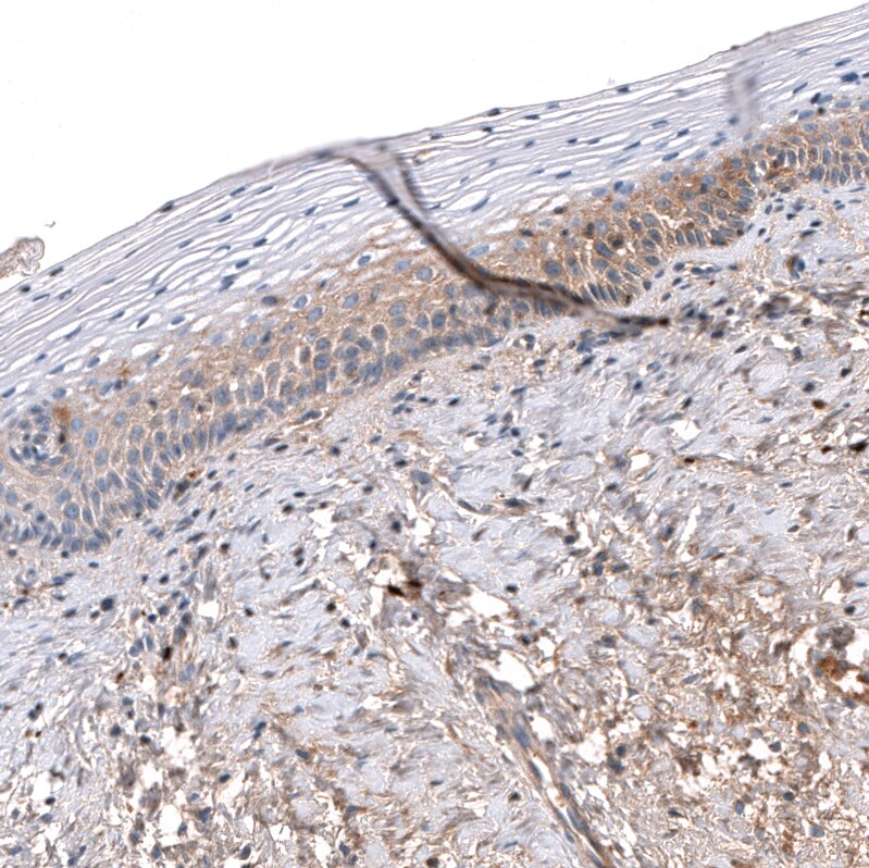 Serpin A3/alpha 1-Antichymotrypsin Antibody (CL10697) - Azide and BSA Free Immunohistochemistry-Paraffin: Serpin A3/alpha 1-Antichymotrypsin Antibody [NBP3-44021]