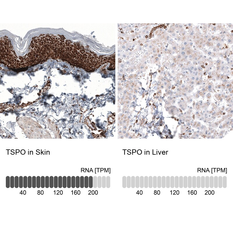 PBR Antibody (CL13359) - Azide and BSA Free Immunohistochemistry-Paraffin: PBR Antibody [NBP3-44022]