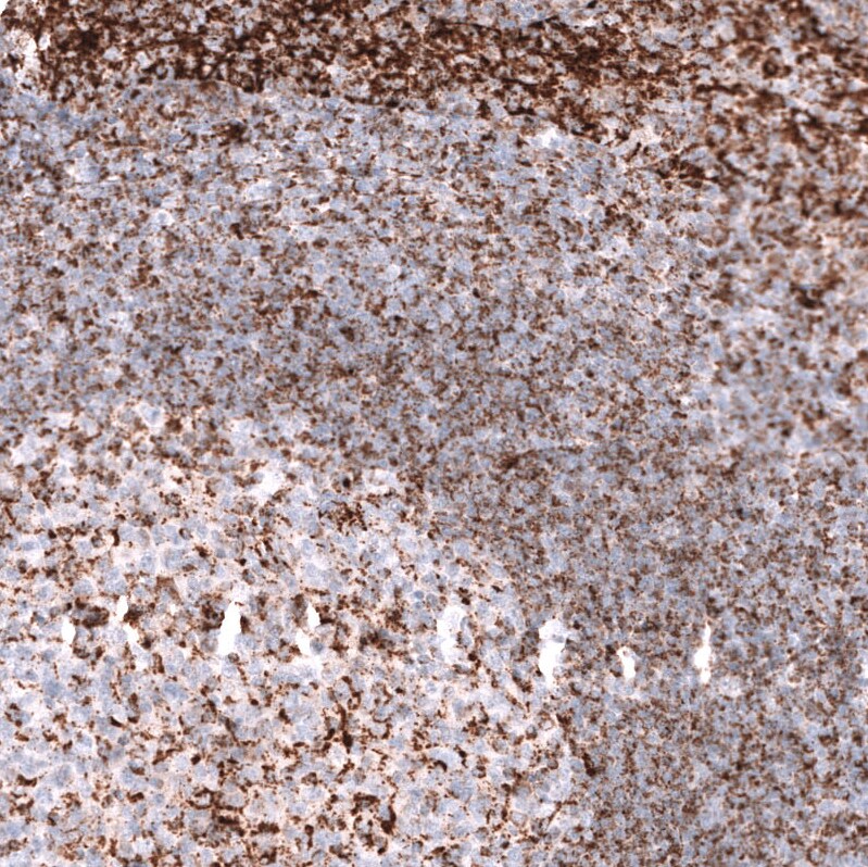 PBR Antibody (CL13359) - Azide and BSA Free Immunohistochemistry-Paraffin: PBR Antibody [NBP3-44022]