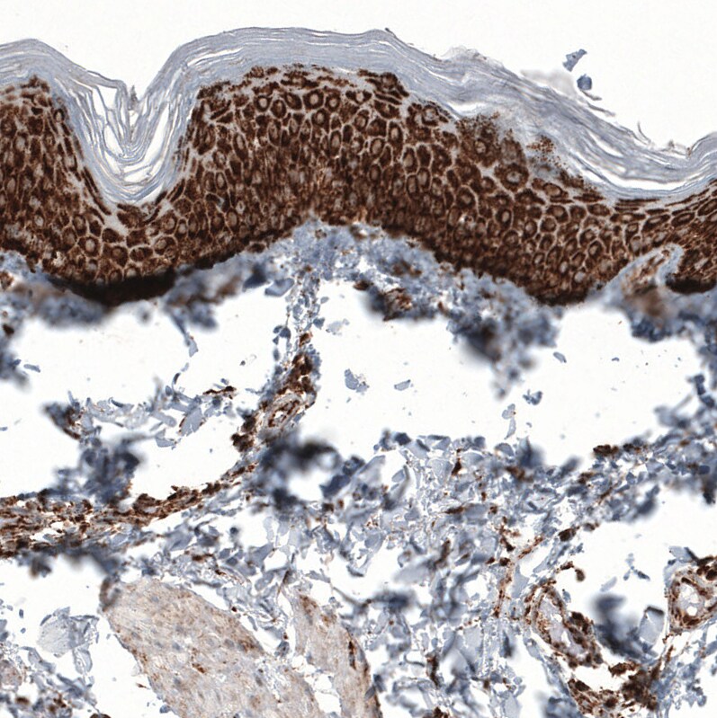 PBR Antibody (CL13359) - Azide and BSA Free Immunohistochemistry-Paraffin: PBR Antibody [NBP3-44022]