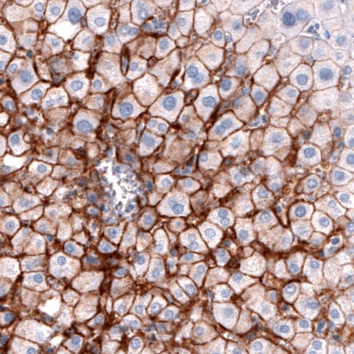 OATP1B3/SLCO1B3/OATP8 Antibody (CL3770) - Azide and BSA Free Immunohistochemistry-Paraffin: OATP1B3/SLCO1B3/OATP8 Antibody [NBP3-44023]