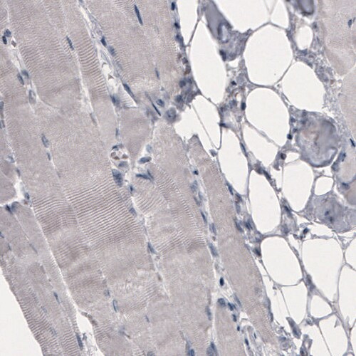 OATP1B3/SLCO1B3/OATP8 Antibody (CL3771) - Azide and BSA Free Immunohistochemistry-Paraffin: OATP1B3/SLCO1B3/OATP8 Antibody [NBP3-44024]