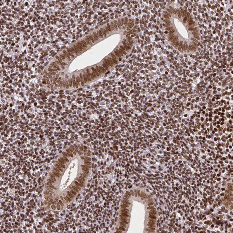 CTCF Antibody (CL0305) - Azide and BSA Free Immunohistochemistry-Paraffin: CTCF Antibody [NBP3-44026]