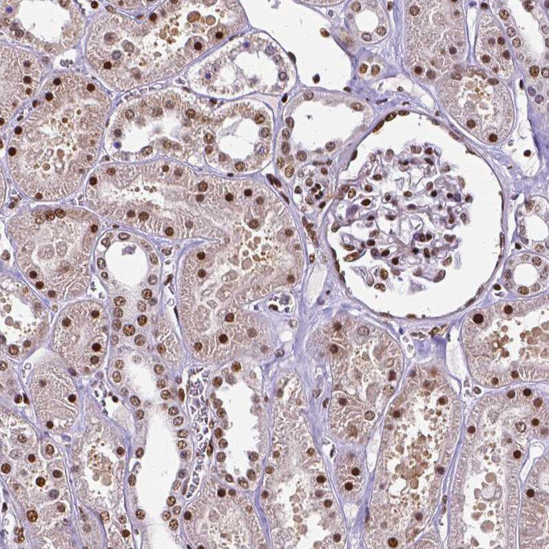 CTCF Antibody (CL0305) - Azide and BSA Free Immunohistochemistry-Paraffin: CTCF Antibody [NBP3-44026]