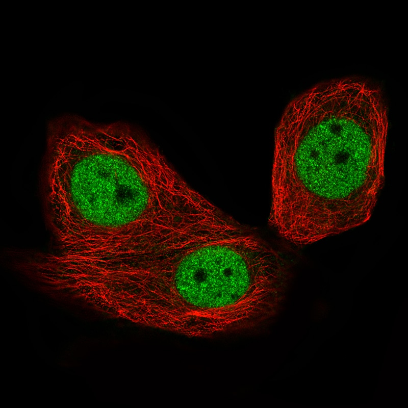 CTCF Antibody (CL0305) - Azide and BSA Free Immunocytochemistry/ Immunofluorescence: CTCF Antibody [NBP3-44026]