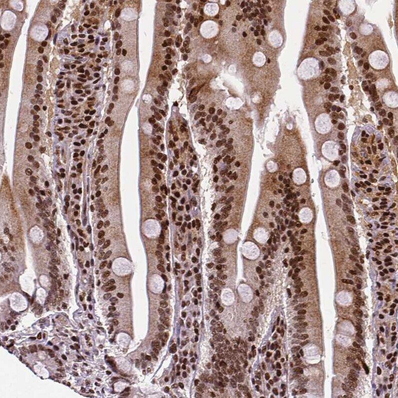 CTCF Antibody (CL0305) - Azide and BSA Free Immunohistochemistry-Paraffin: CTCF Antibody [NBP3-44026]