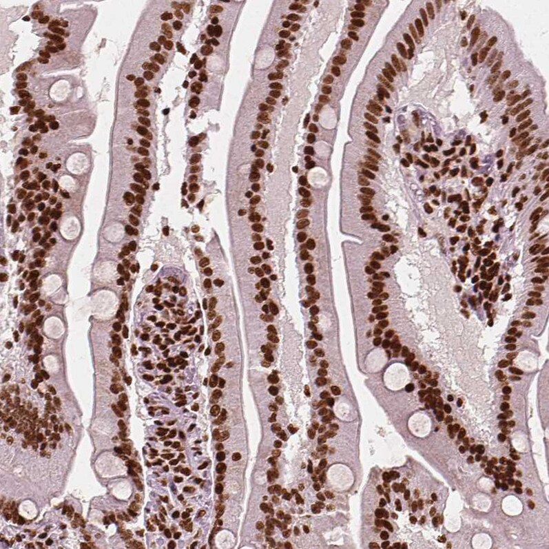 CTCF Antibody (CL0307) - Azide and BSA Free Immunohistochemistry-Paraffin: CTCF Antibody [NBP3-44027]