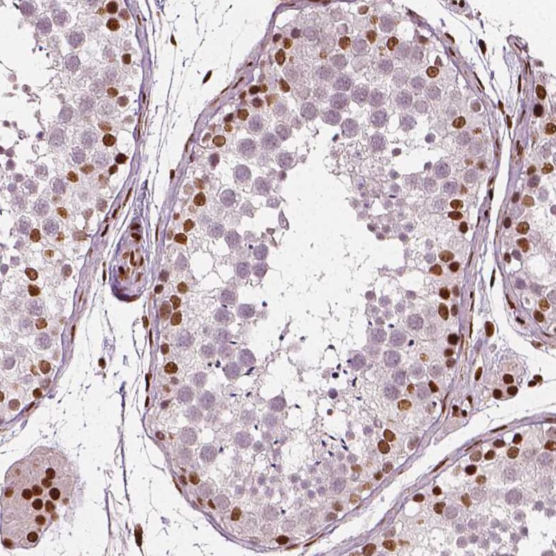 CTCF Antibody (CL0307) - Azide and BSA Free Immunohistochemistry-Paraffin: CTCF Antibody [NBP3-44027]
