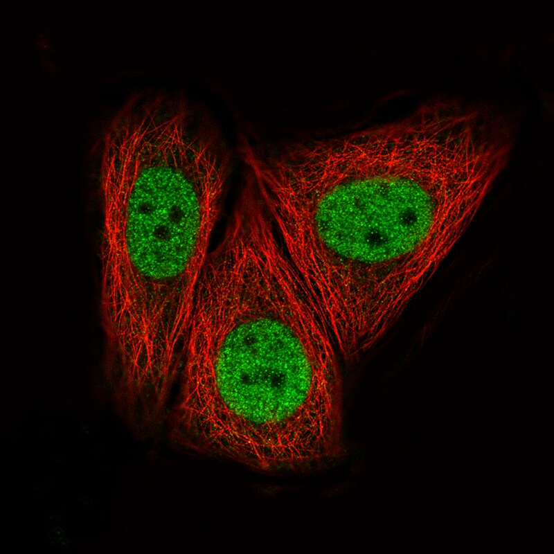 CTCF Antibody (CL0307) - Azide and BSA Free Immunocytochemistry/ Immunofluorescence: CTCF Antibody [NBP3-44027]