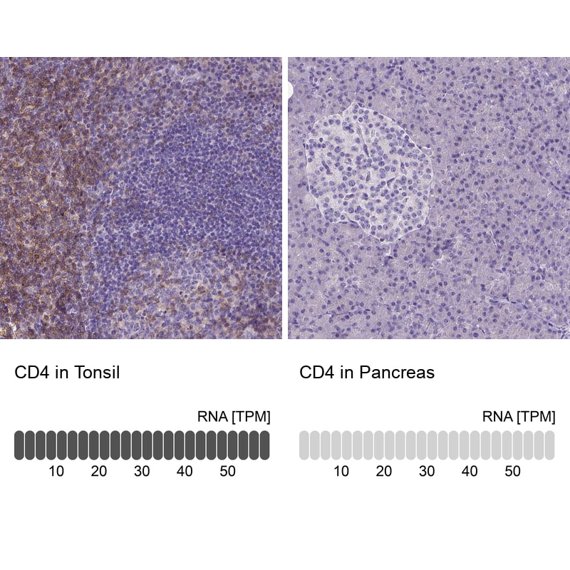 CD4 Antibody (CL0395) - Azide and BSA Free Immunohistochemistry-Paraffin: CD4 Antibody [NBP3-44029]