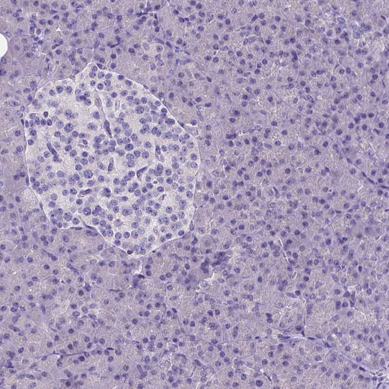 CD4 Antibody (CL0395) - Azide and BSA Free Immunohistochemistry-Paraffin: CD4 Antibody [NBP3-44029]