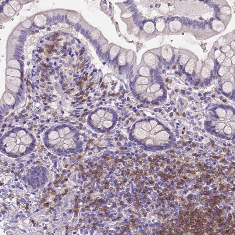 CD4 Antibody (CL0395) - Azide and BSA Free Immunohistochemistry-Paraffin: CD4 Antibody [NBP3-44029]