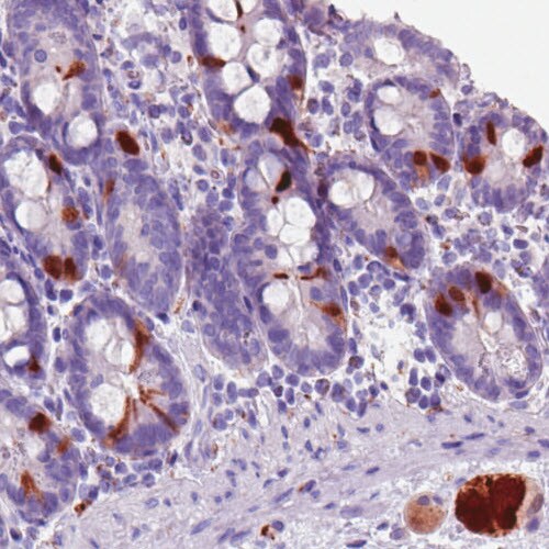 Secretagogin Antibody (CL0271) - Azide and BSA Free Immunohistochemistry-Paraffin: Secretagogin Antibody [NBP3-44030]