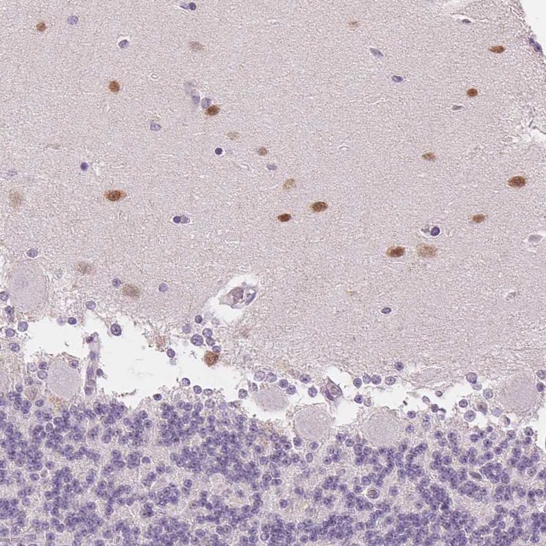 Secretagogin Antibody (CL0273) - Azide and BSA Free Immunohistochemistry-Paraffin: Secretagogin Antibody [NBP3-44031]
