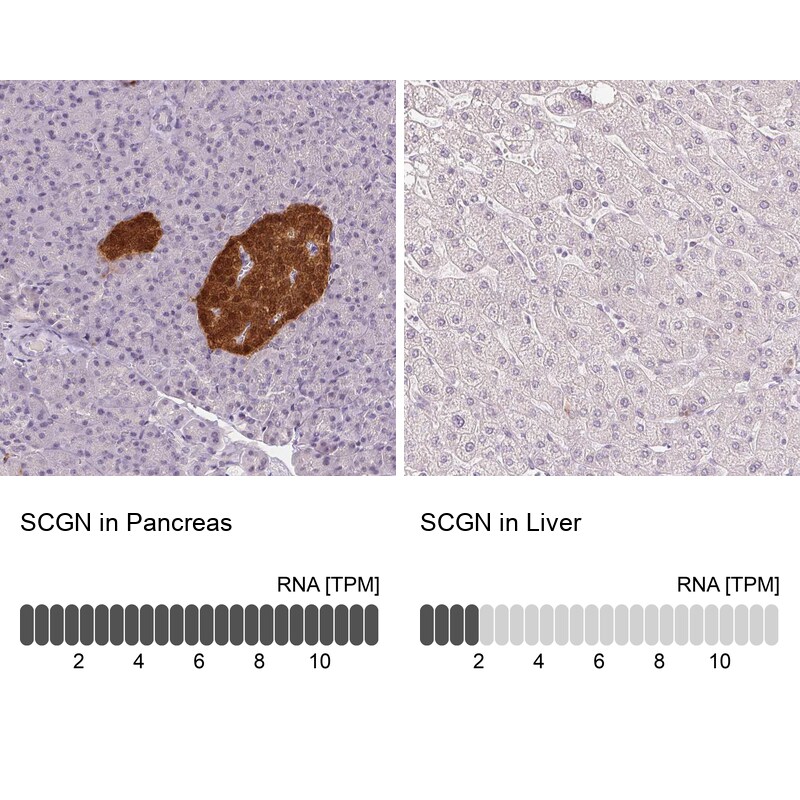 Secretagogin Antibody (CL0273) - Azide and BSA Free Immunohistochemistry-Paraffin: Secretagogin Antibody [NBP3-44031]