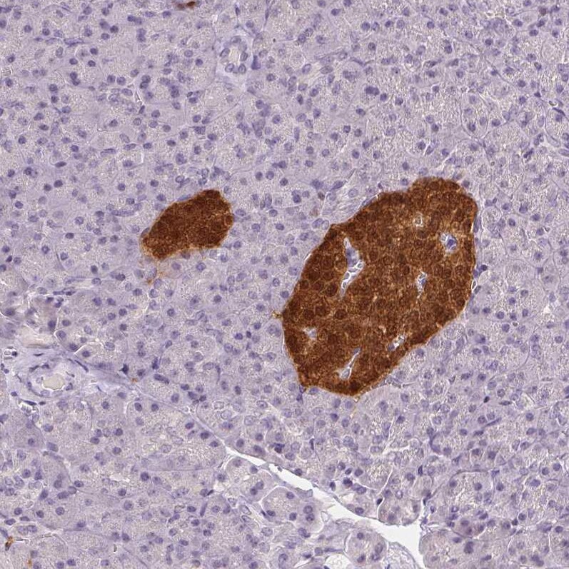 Secretagogin Antibody (CL0273) - Azide and BSA Free Immunohistochemistry-Paraffin: Secretagogin Antibody [NBP3-44031]