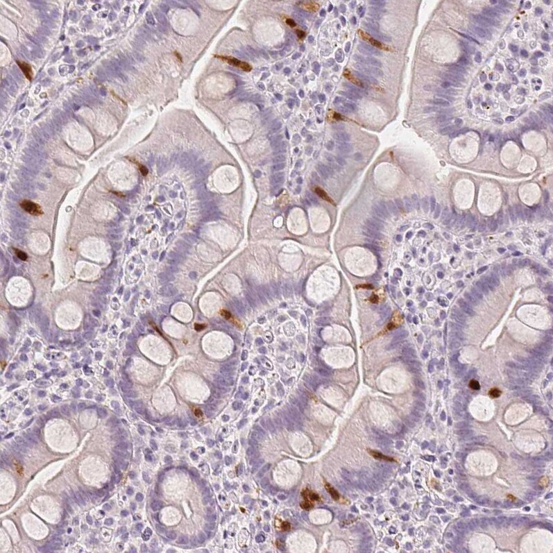 Secretagogin Antibody (CL0273) - Azide and BSA Free Immunohistochemistry-Paraffin: Secretagogin Antibody [NBP3-44031]
