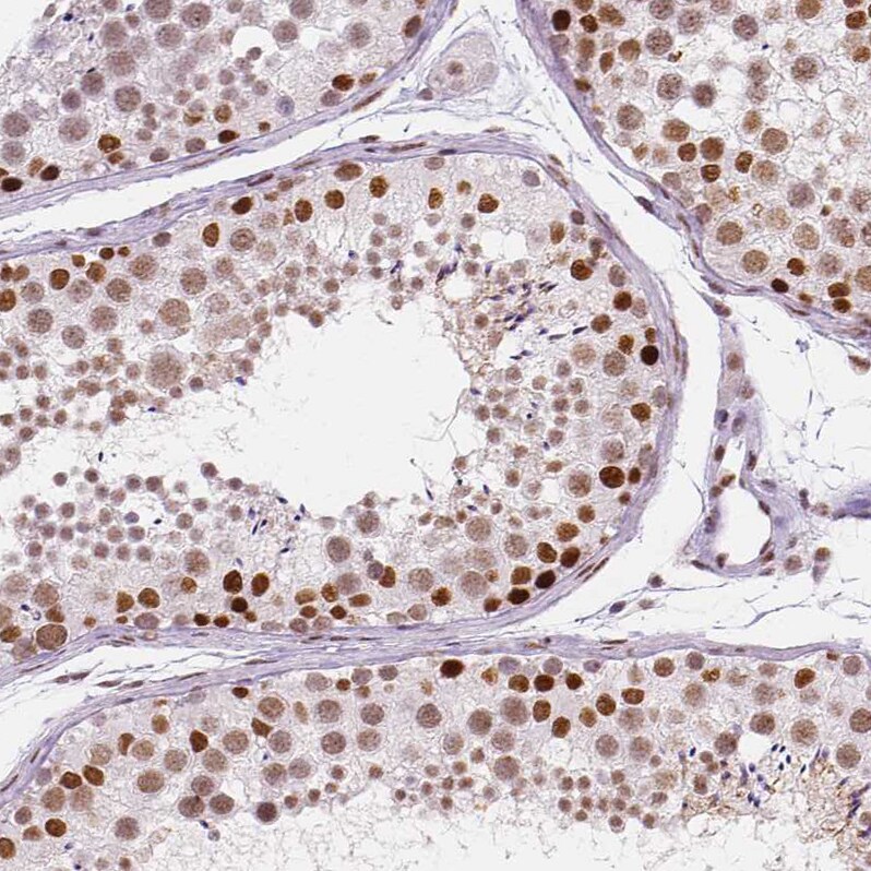 HDAC1 Antibody (CL0510) - Azide and BSA Free Immunohistochemistry-Paraffin: HDAC1 Antibody [NBP3-44032]