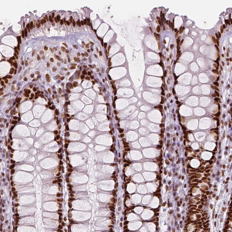 HDAC1 Antibody (CL0510) - Azide and BSA Free Immunohistochemistry-Paraffin: HDAC1 Antibody [NBP3-44032]