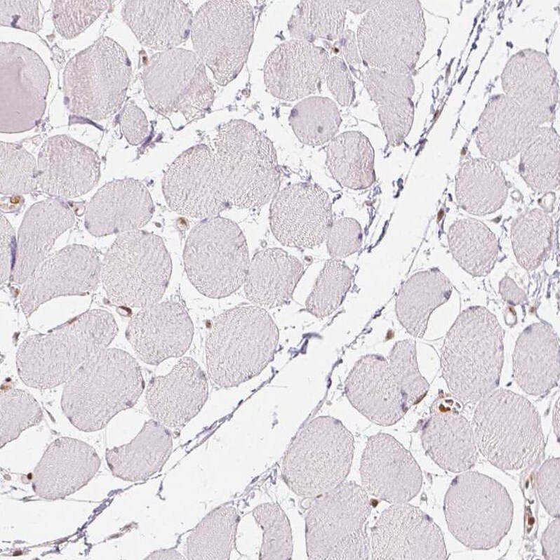 HDAC1 Antibody (CL0510) - Azide and BSA Free Immunohistochemistry-Paraffin: HDAC1 Antibody [NBP3-44032]