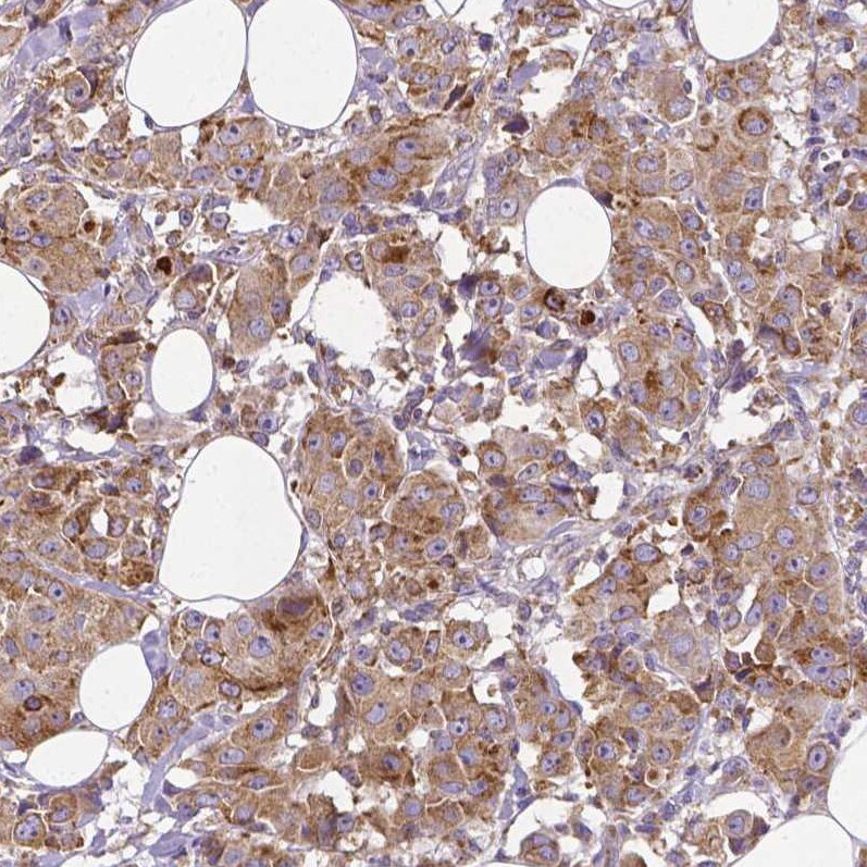Metadherin Antibody (CL0401) - Azide and BSA Free Immunohistochemistry-Paraffin: Metadherin Antibody [NBP3-44033]
