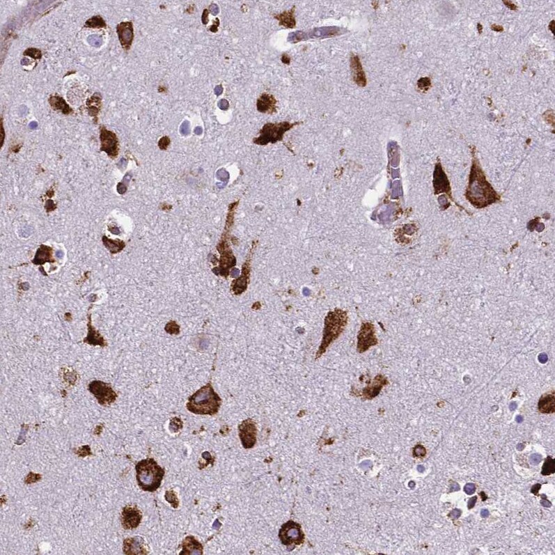 Metadherin Antibody (CL0397) - Azide and BSA Free Immunohistochemistry-Paraffin: Metadherin Antibody [NBP3-44034]