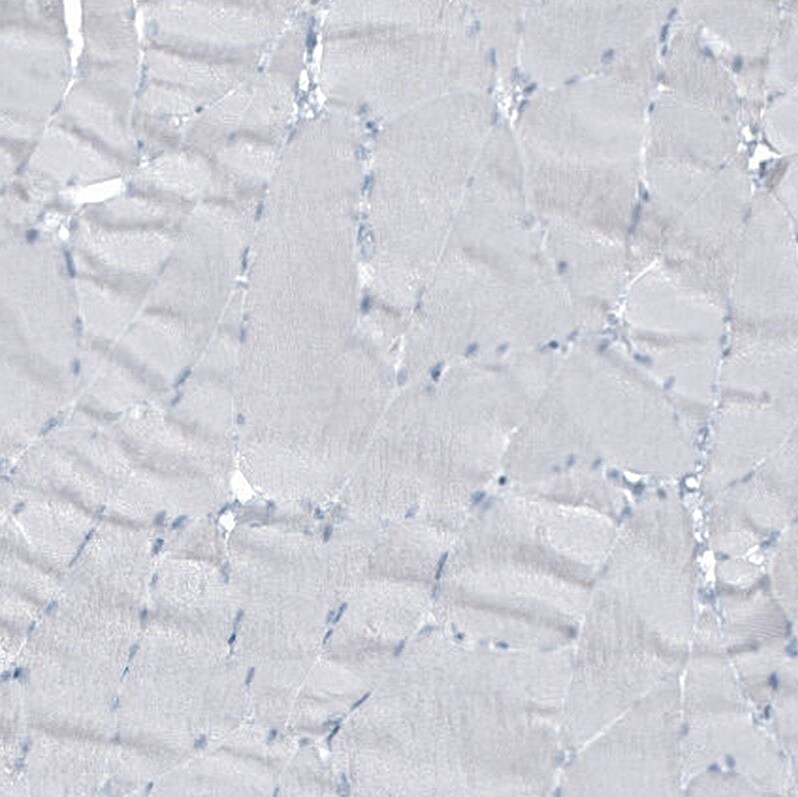 Cytokeratin 7 Antibody (CL8723) - Azide and BSA Free Immunohistochemistry-Paraffin: Cytokeratin 7 Antibody [NBP3-44035]